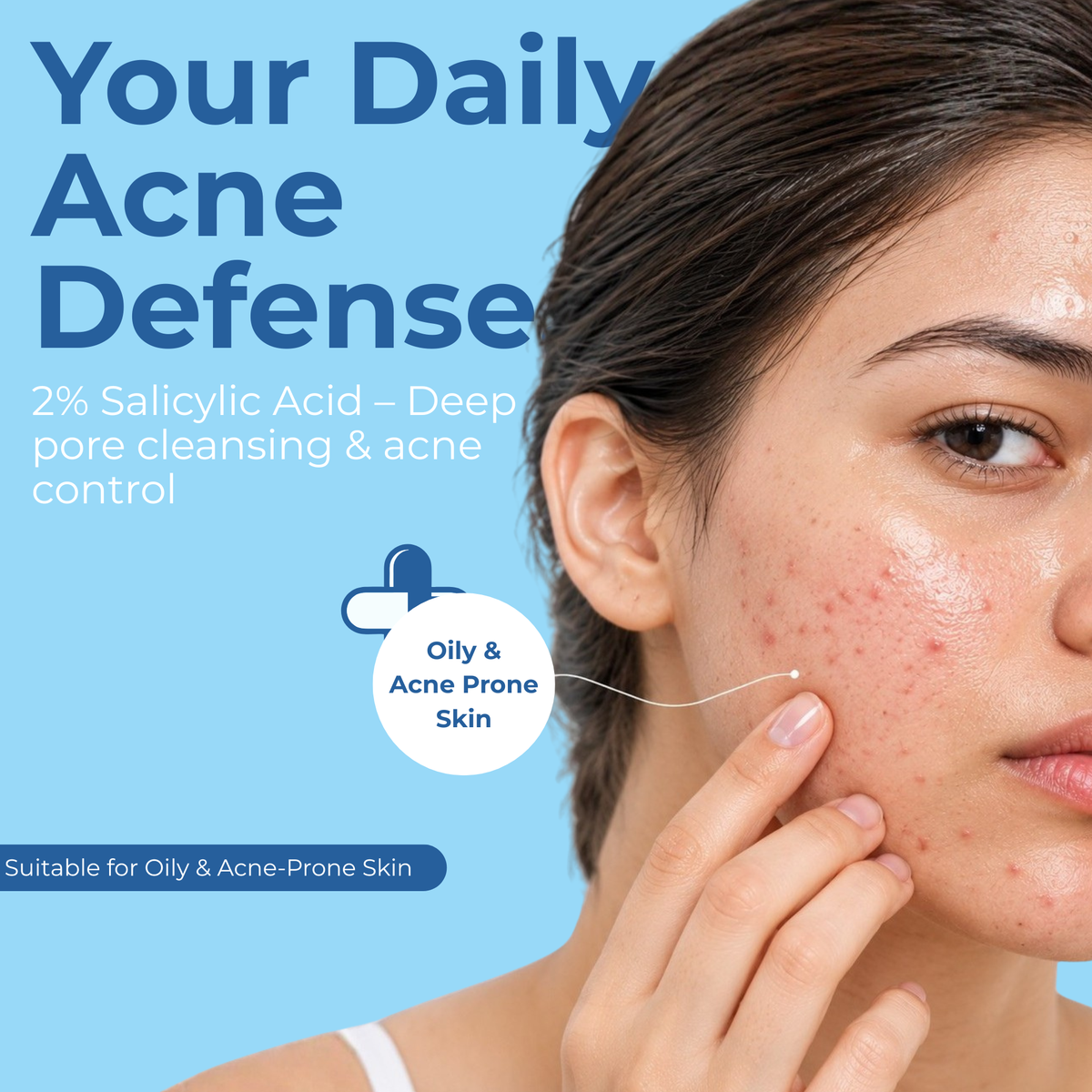 DERMACELLS 2% Salicylic Acid Face Serum 30ml | Acne & Pimple Control Serum with Witch Hazel & Willow Bark | Oil-Free, Clear Skin Formula